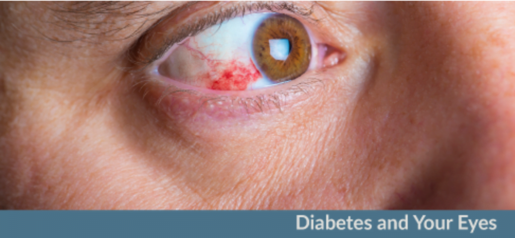 diabetes and eye problems